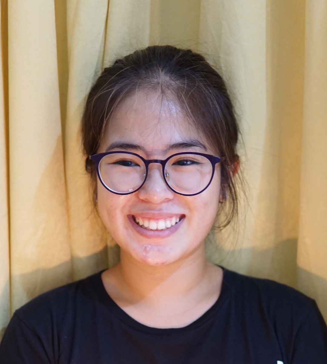 Melawan Jerawat: Nyobain Acne Patch